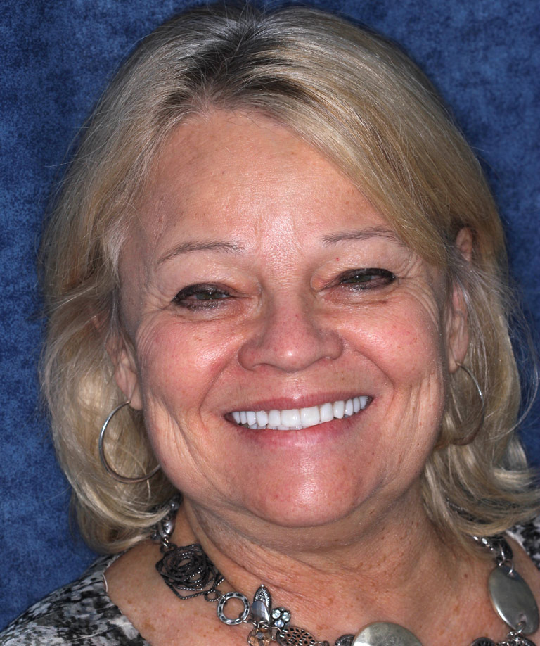 Headshot photo of Carolyn smiling showing smile makeover results from Dr. Brooksher