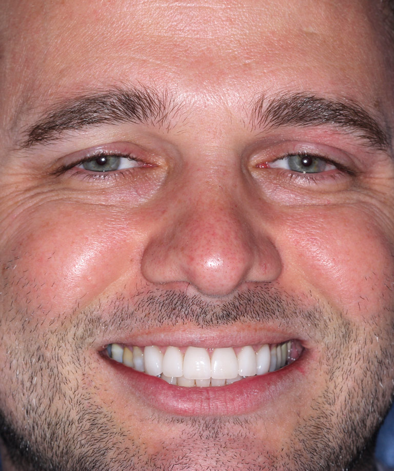 Headshot photo of Jeremy smiling showing smile makeover results from Dr. Brooksher