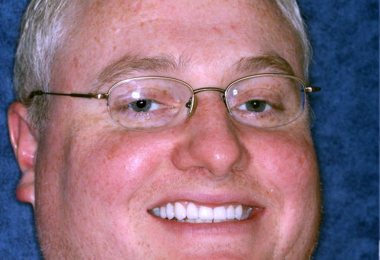 Headshot photo of Keith smiling after smile makeover