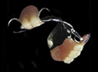 Diagram of a partial denture with a metal clasp